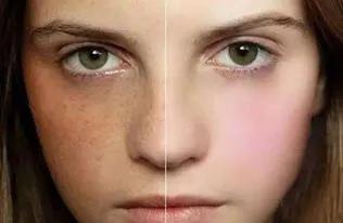 中药化痰祛湿良方,中药有较快消除痰栓的吗