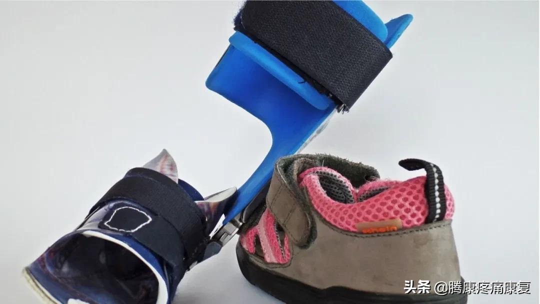 功能性高足弓的练习方式,足弓疼痛3个动作缓解