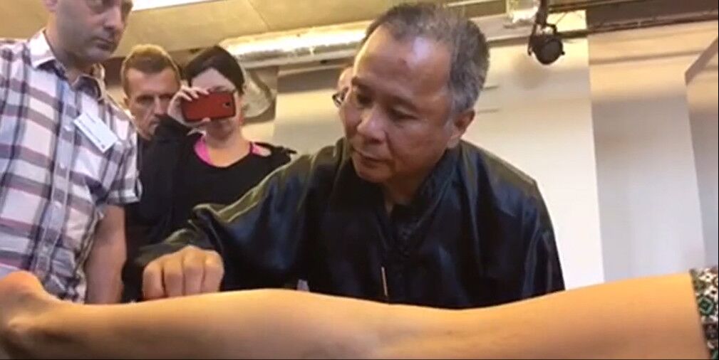 五运六气与五行旺衰运,黄贵生五运六气针法