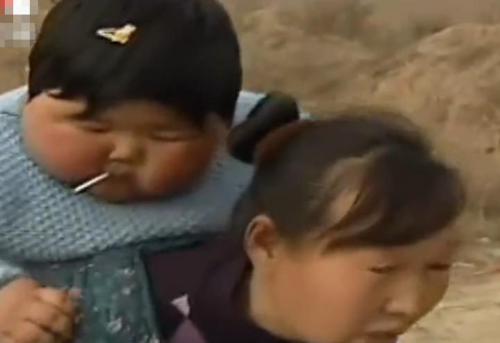 10岁女孩体重120斤怎么办,2岁女童体重高达92斤