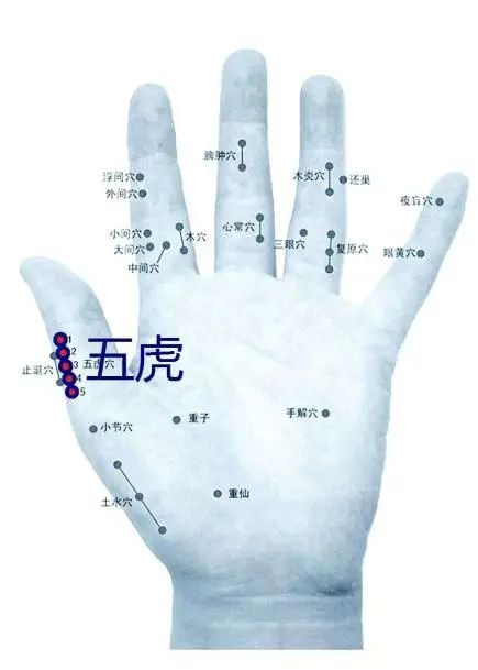 坐骨神经痛董氏针灸,董氏针灸治疗坐骨结节滑囊炎