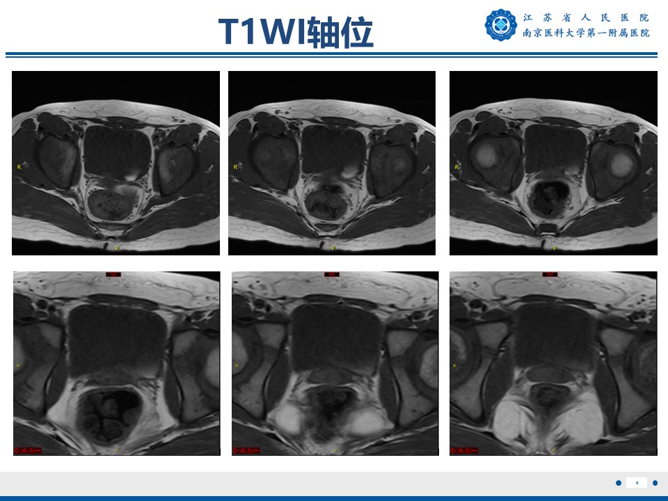 好文分享——《胚胎型横纹肌肉瘤》