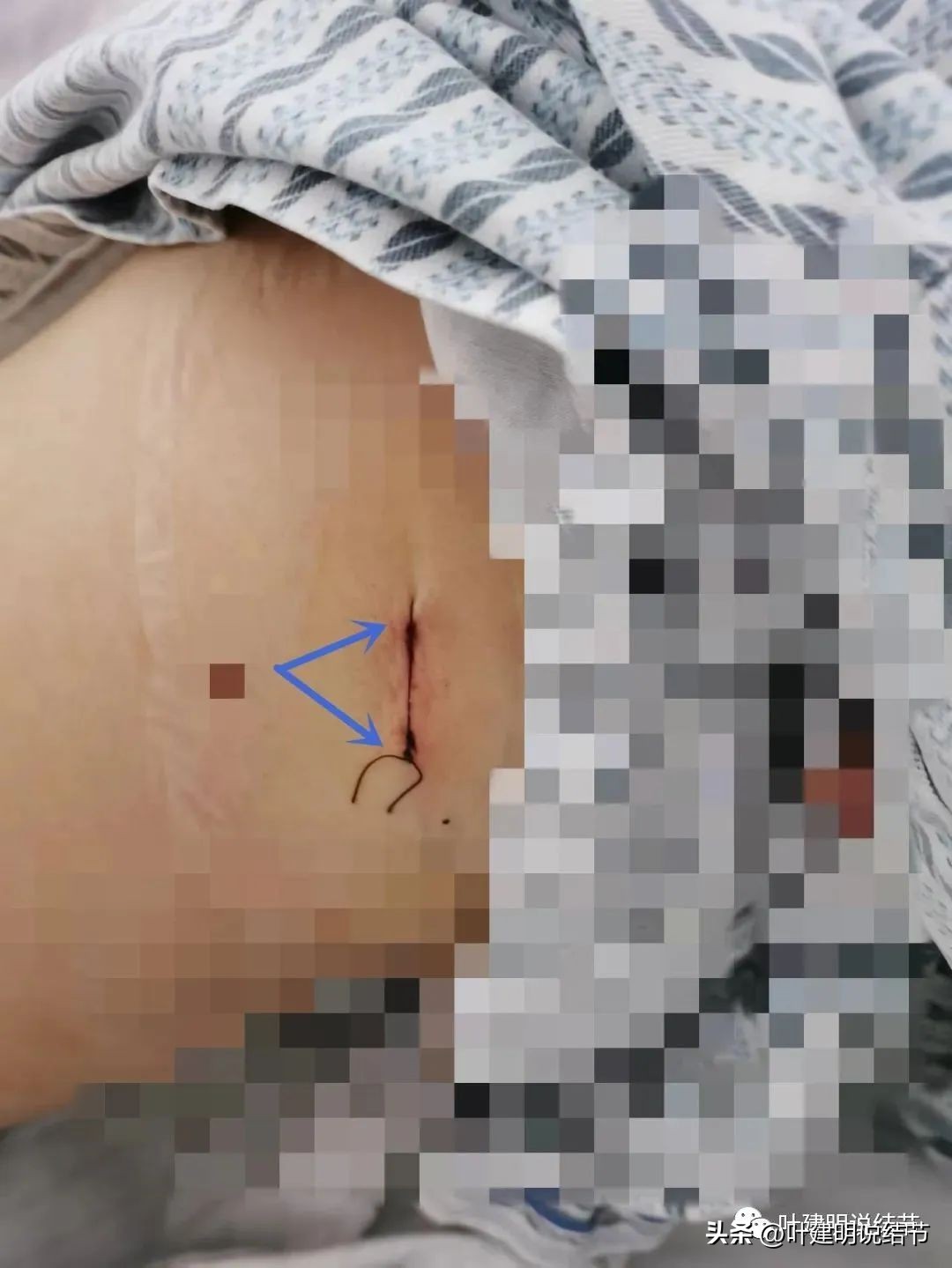 成立肺癌诊疗一体化中心,构建肺癌精准诊疗生态圈