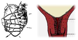 孕妈妈怎么判断胎位是正的,胎儿屁股在右侧是什么胎位