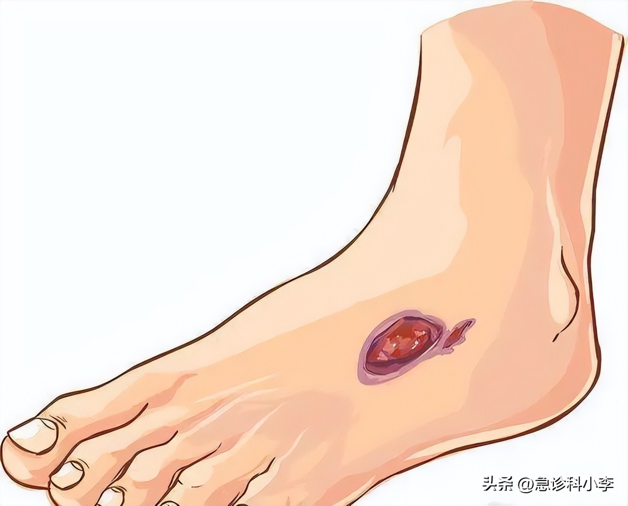 甲钴胺可以修复脑部神经受损吗,大脑中枢神经受损吃甲钴胺可以吗