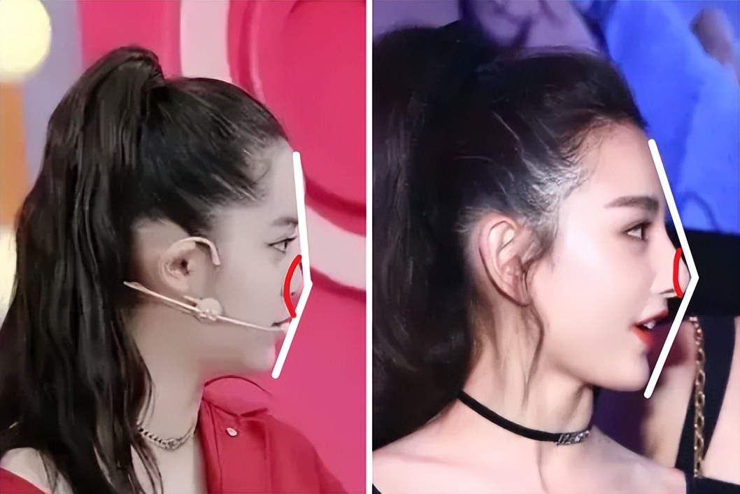 为什么大部分亚洲人都是扁头,正脸好看但侧脸丑到爆怎样办