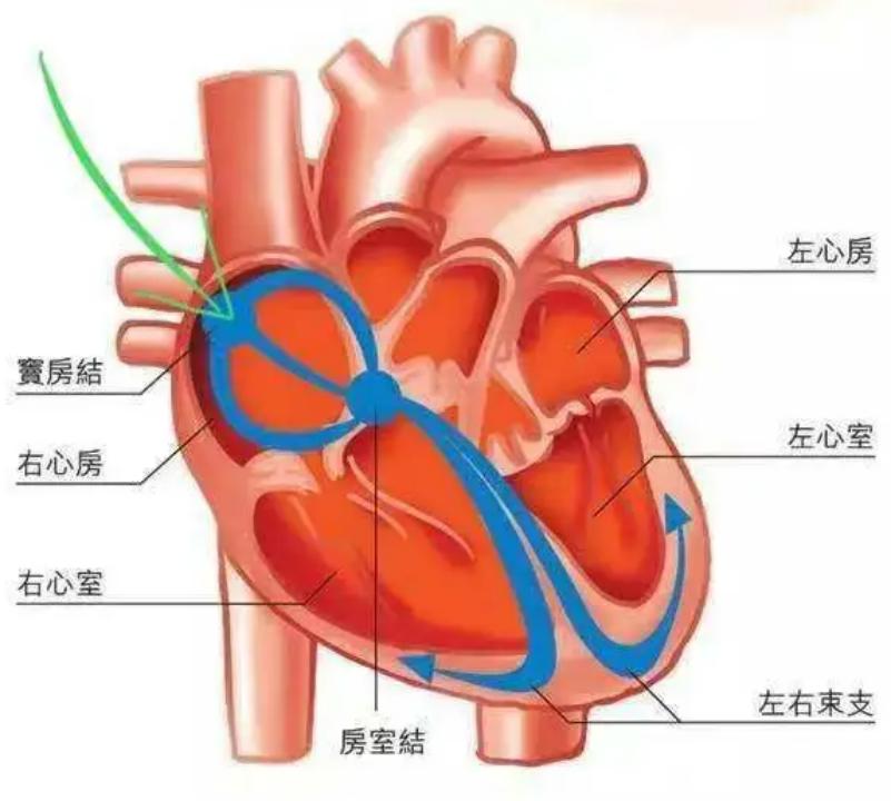 心律失常室性早搏是怎么回事,心律失常室性早搏能治好吗