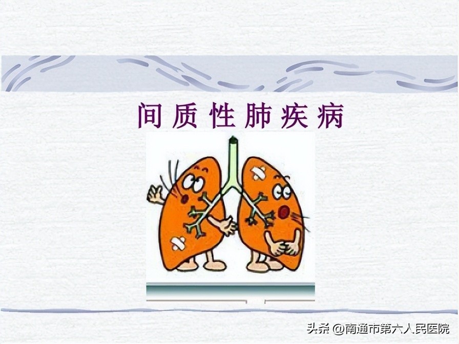 新冠肺炎间质性肺疾病,新冠肺炎疫情中医专家