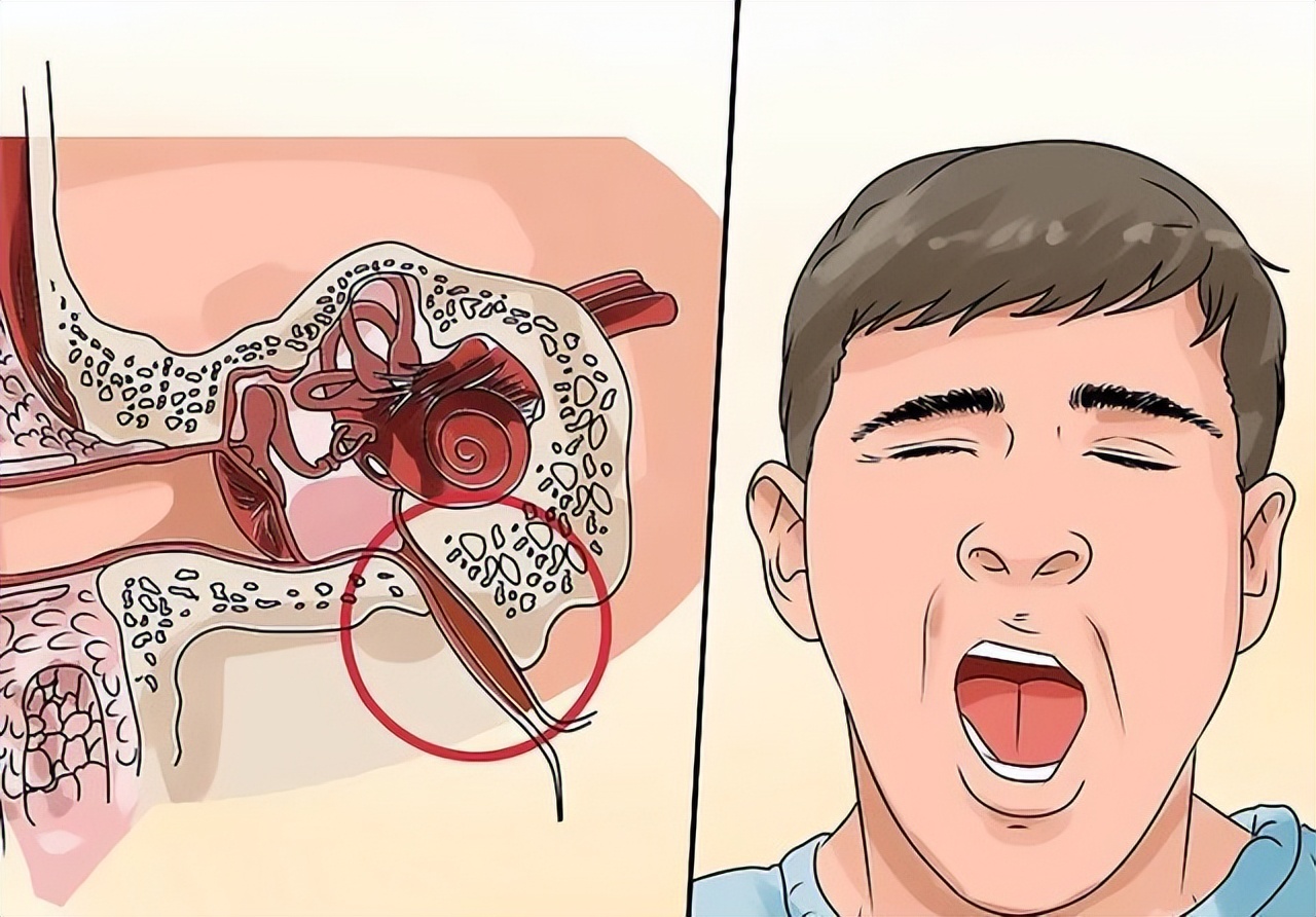 耳朵里面一咽口水就响怎么回事,一咽口水耳朵就响是上火了吗