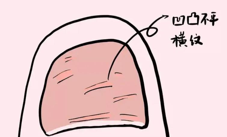 指甲如何看气血不足,怎么通过指甲判断气血不足