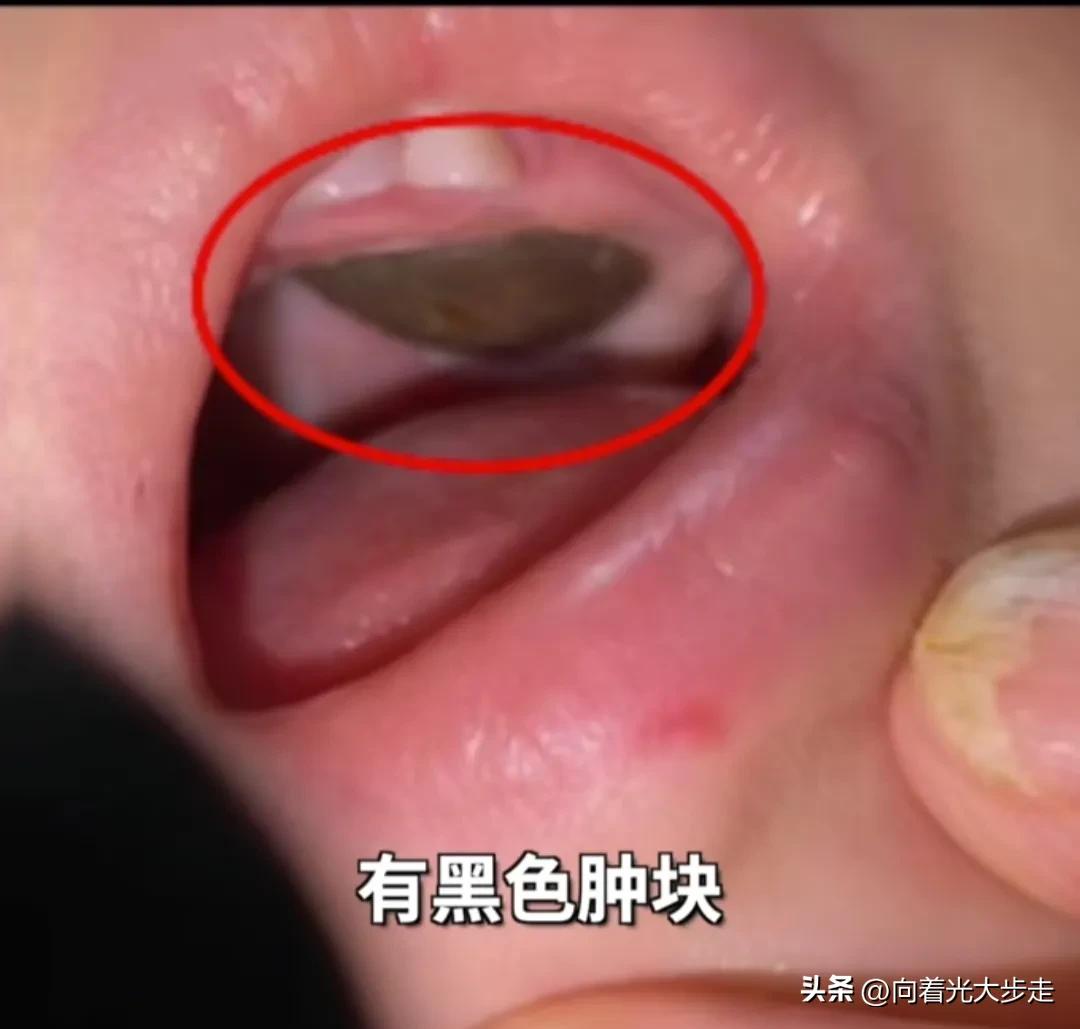 湘雅医院事件是怎么被曝光的,湘雅丑闻