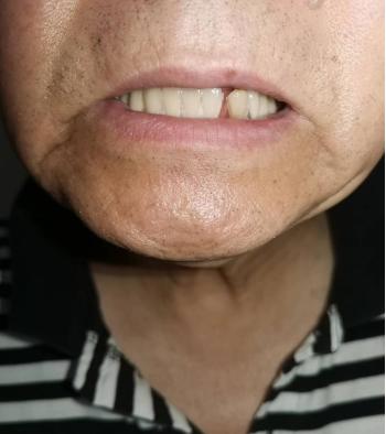 牙科诊所质量问题怎么投诉,上海哪家口腔医院装牙好