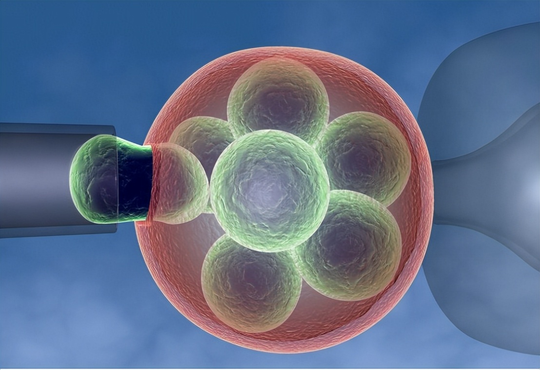 烧伤患者创面处理,烧伤创面处理的原则主要是