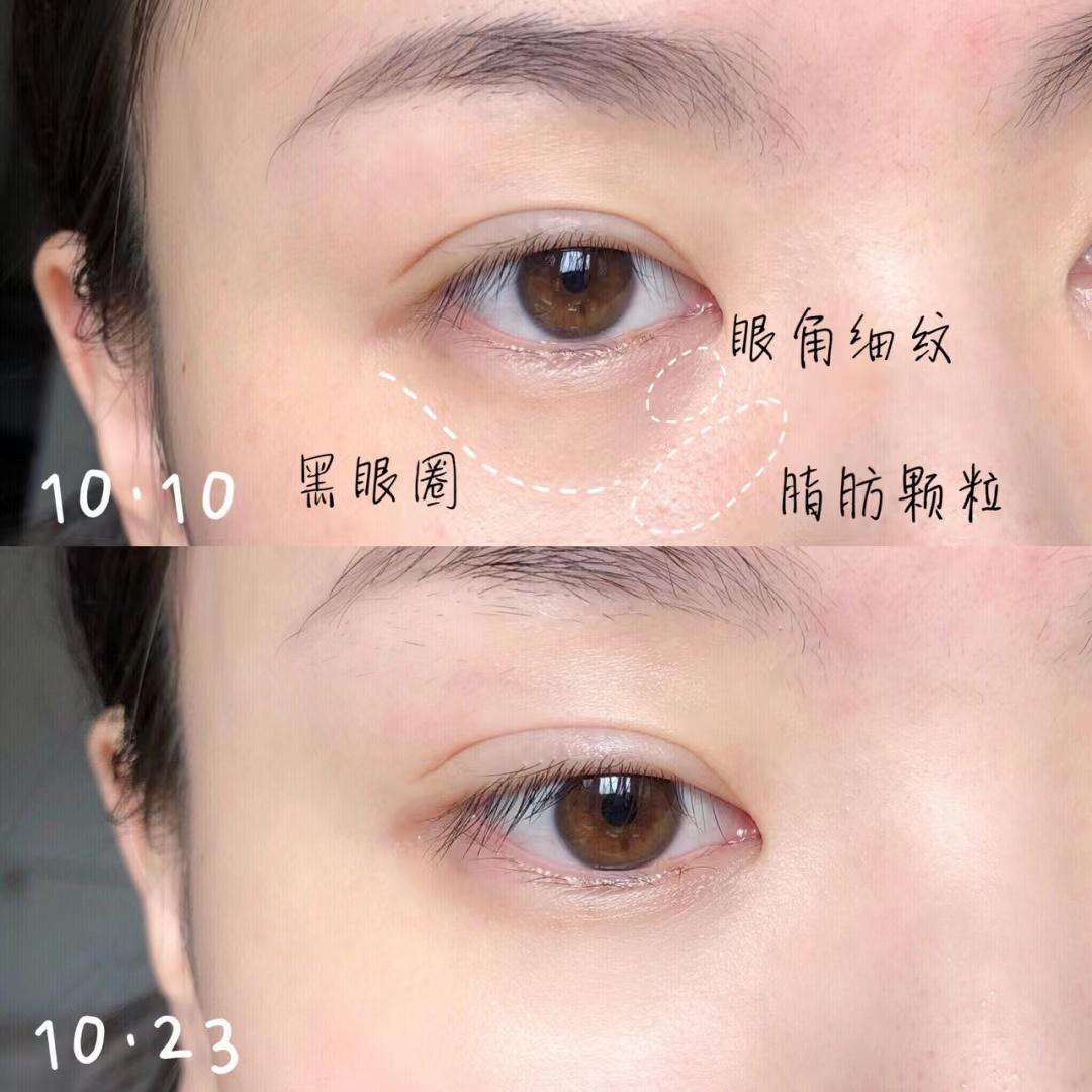 眼霜用多一点有效还是少一点,眼霜到底怎么用比较正确