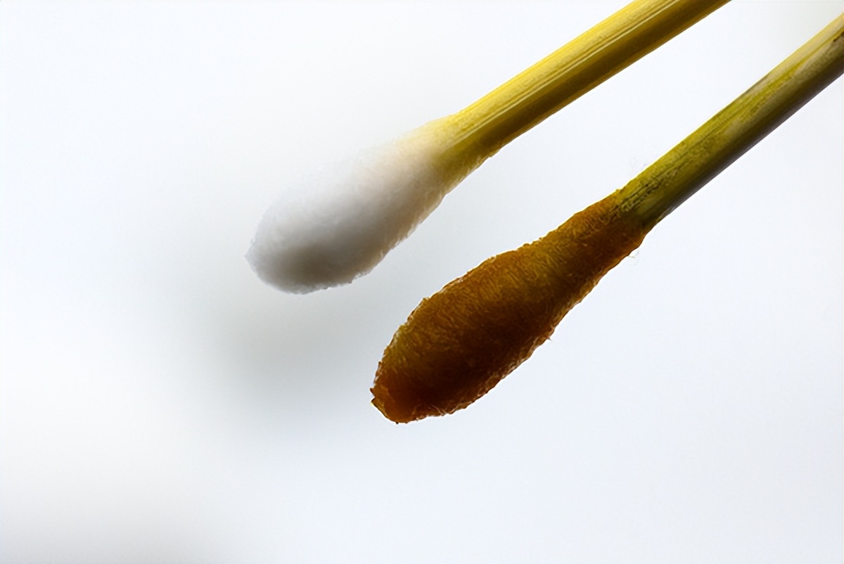 术后伤口消毒用酒精好还是碘伏好,酒精和碘伏双氧水的区别是什么