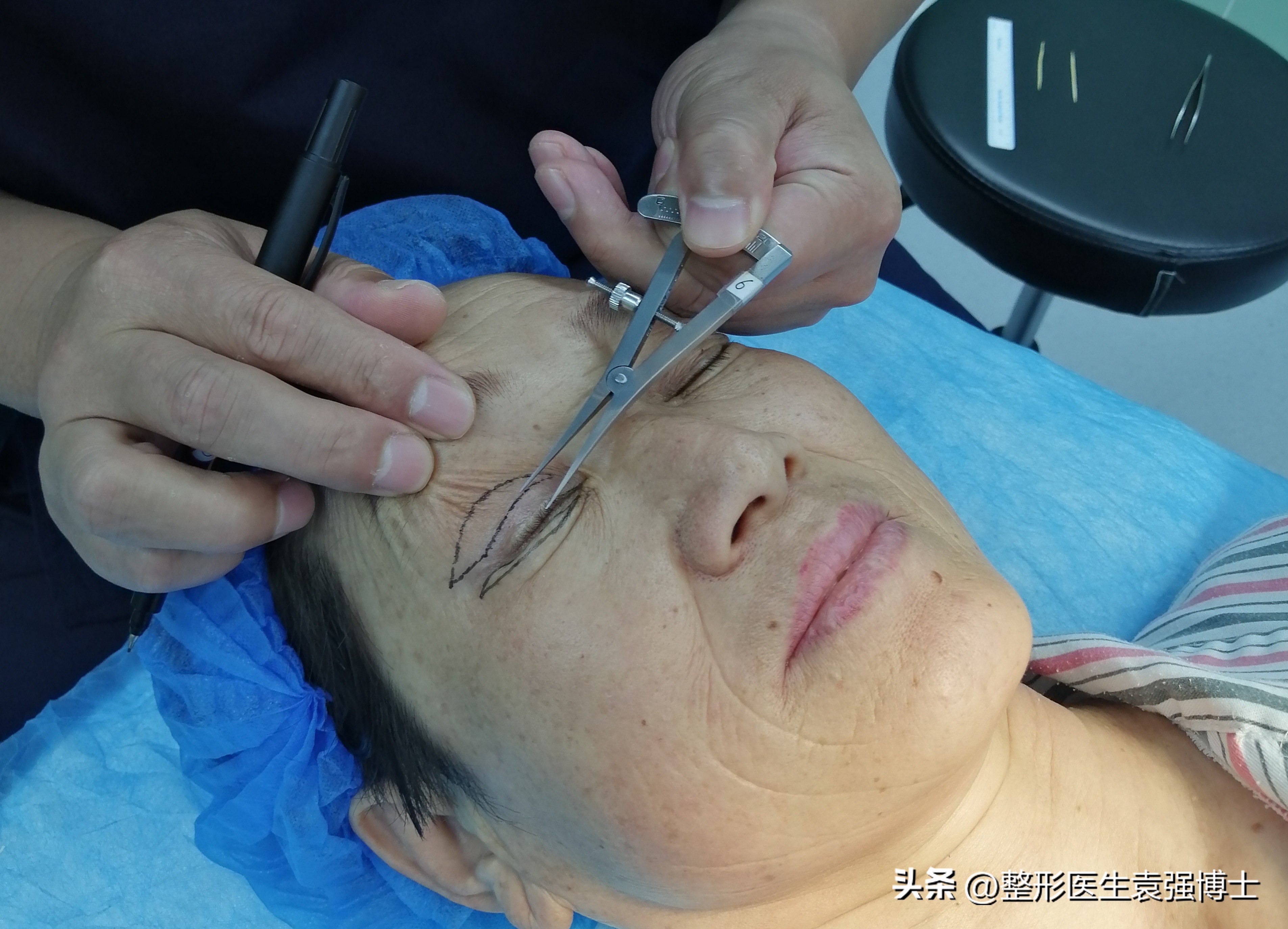 上眼皮耷拉、三角眼、眼皮松，医生说这两种方法很实用