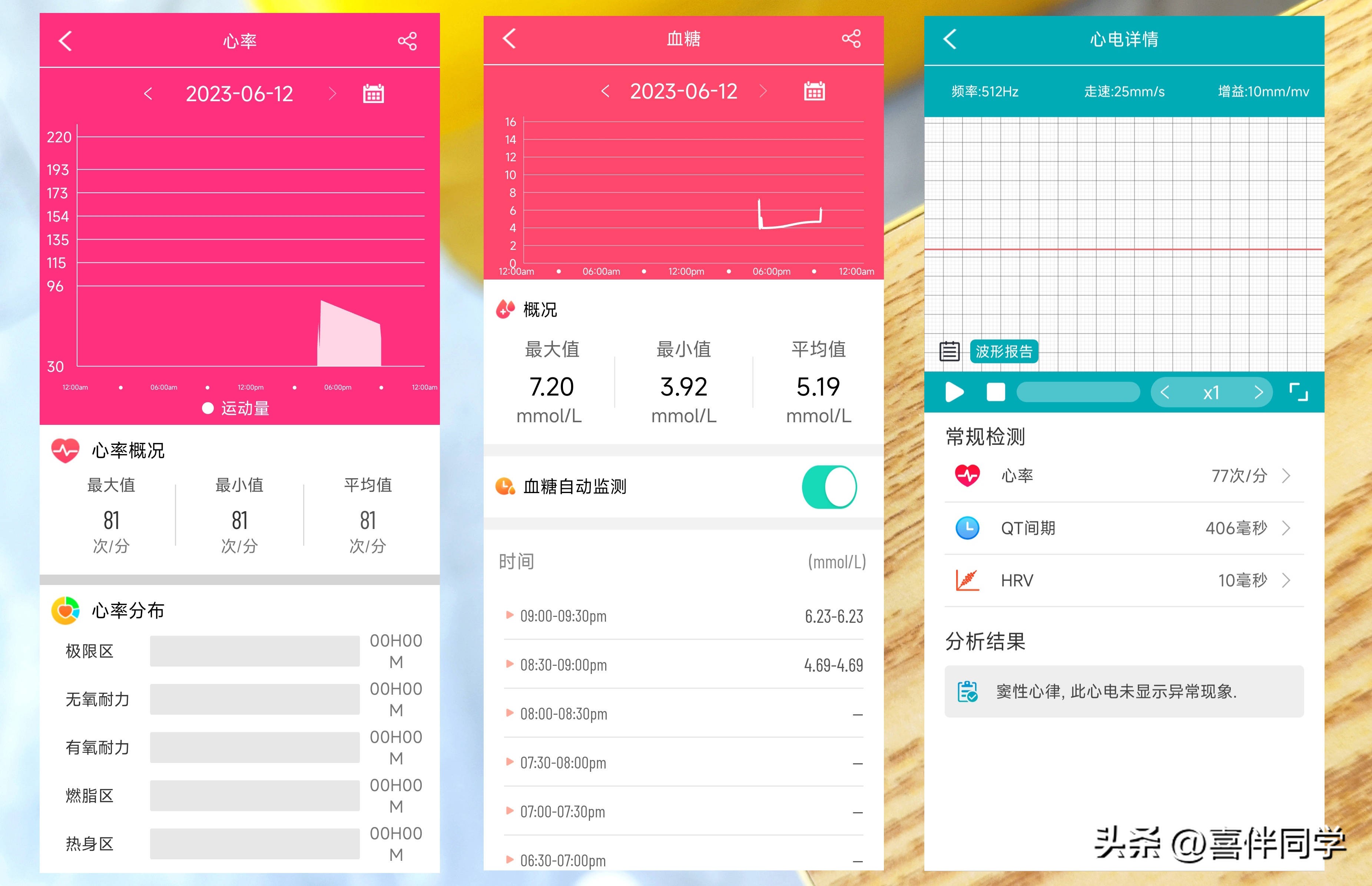 智能测血压心率手环,测血压心电图心率手环推荐