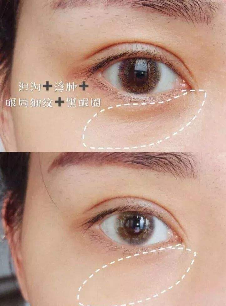 眼霜排名十大公认好用的眼霜抗皱,眼霜排名十大公认好用的抗皱眼霜