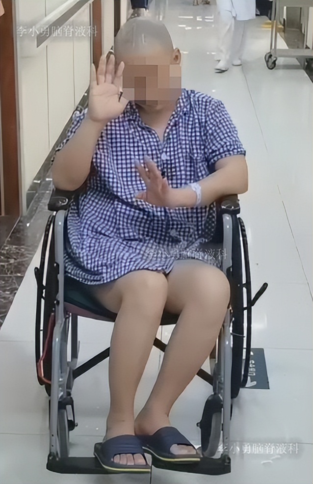 脑积水三脑室造瘘多久能恢复,脑囊虫手术后脑积水