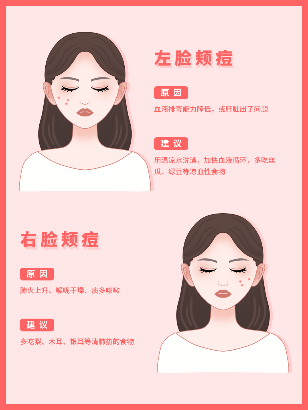 脸颊总是长痘的原因和治疗方法,脸部各部分长痘原因及解决方案