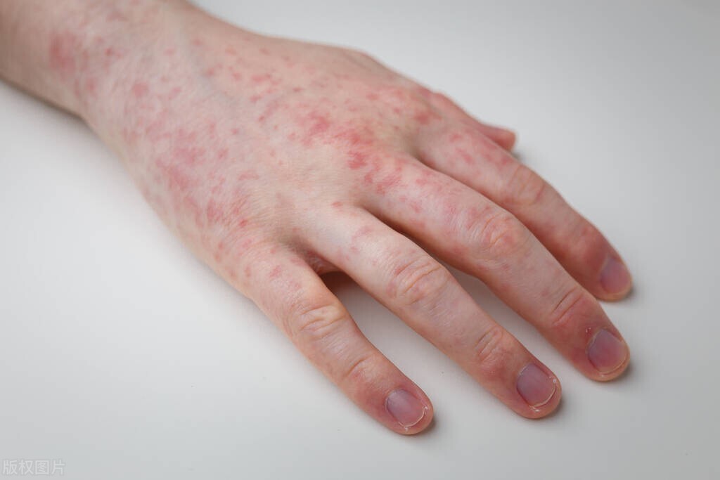 安全套真的安全吗,安全套就一定安全了吗