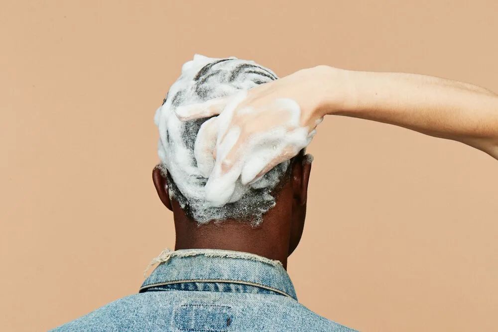 植发生意究竟有多暴利,植发暴不暴利