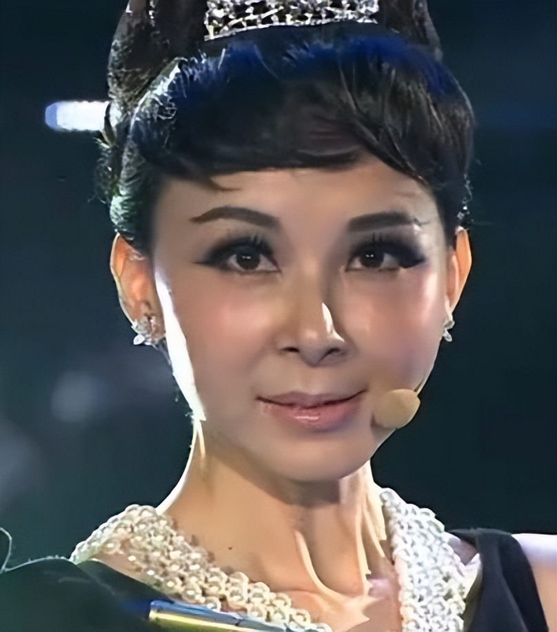 台湾艺人整形记：削骨换脸小意思，嫁给美容医师能终身保修