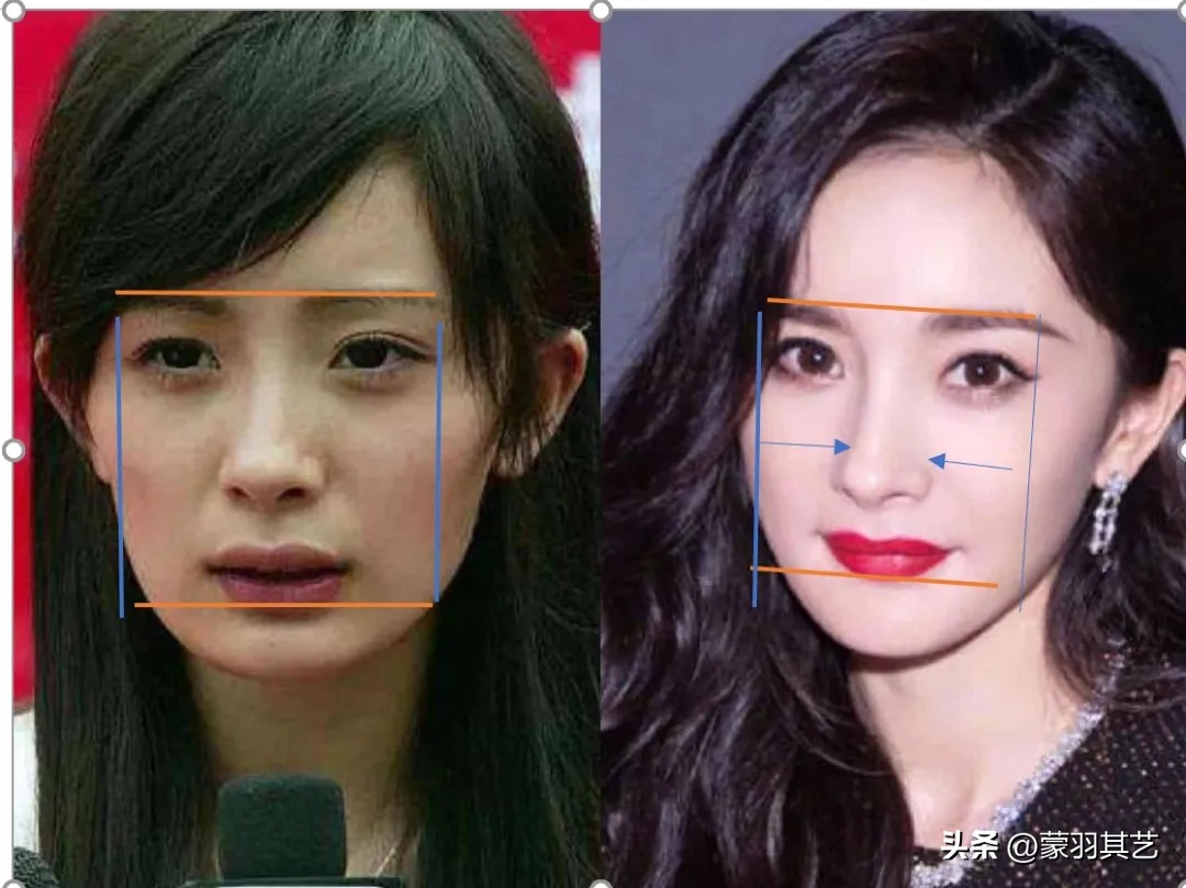 希望有一天，能禁止“整容脸”出镜，满屏硅胶玻尿酸，实在看吐了