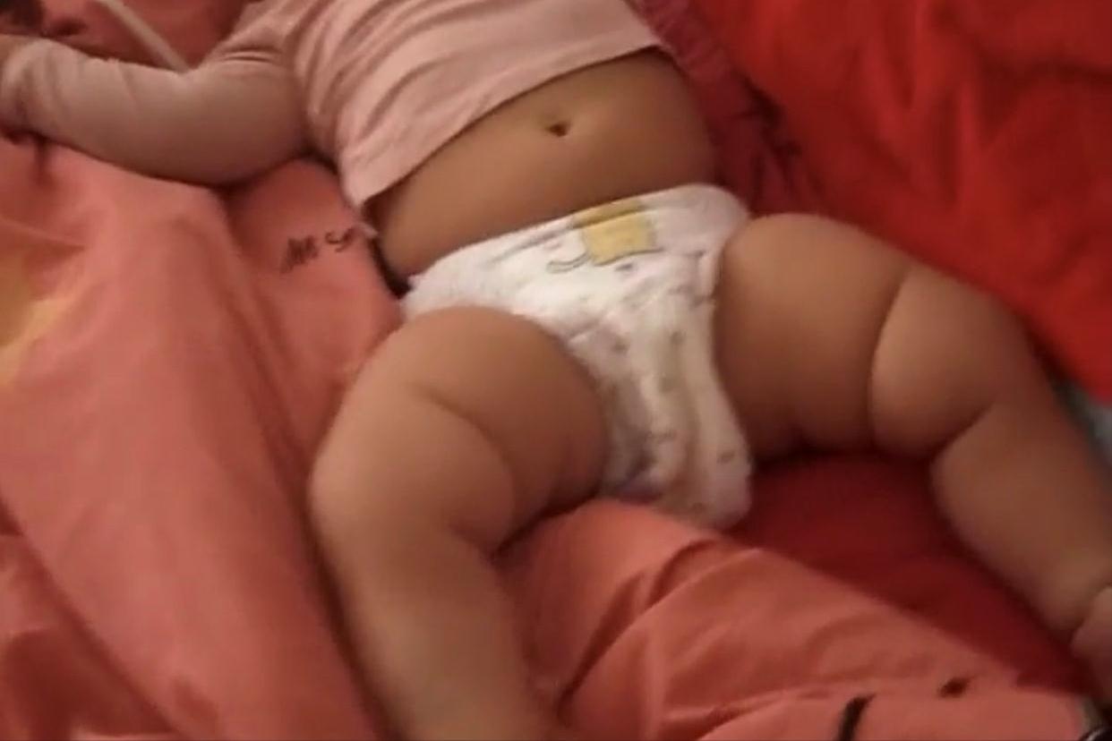 宝宝的身体很热头部不热,热天宝宝踢被子不盖会不会感冒