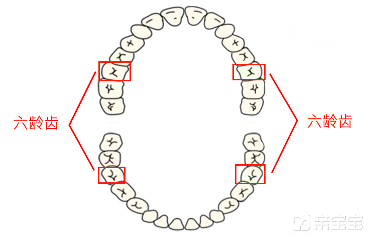六龄齿龋坏怎么修复,孩子的六龄齿有个龋洞怎么办