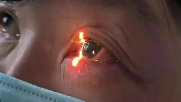 56岁的岳母阳性后一直头疼，女婿送医后，医生大赞：送医太及时了