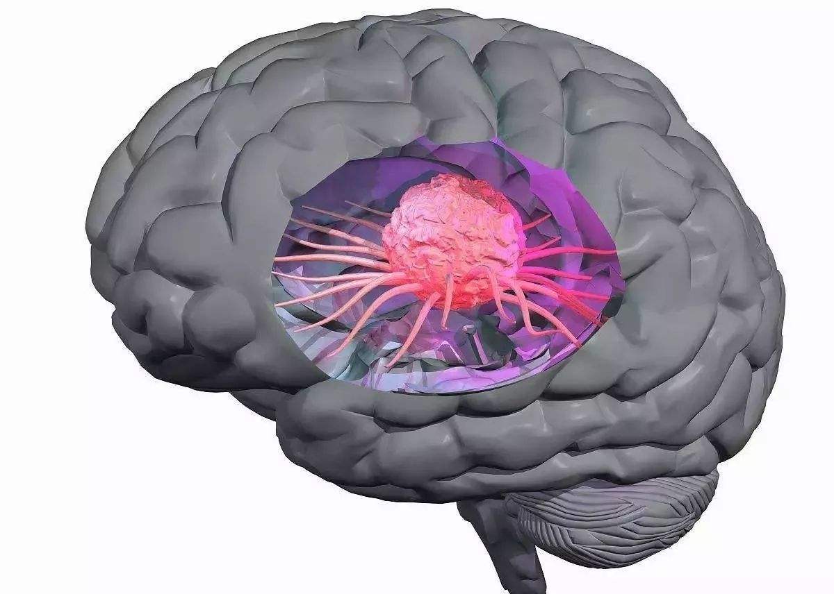 肝癌小细胞癌的治疗方法,肝癌的诊断和治疗方法简答题