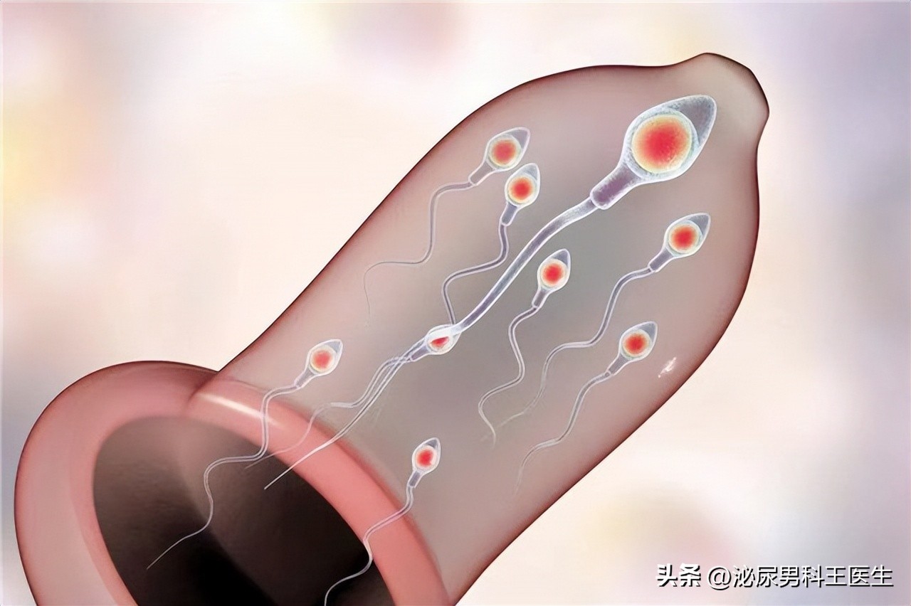 节育环多大年龄取出好取,节育环一直不摘