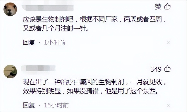 冯小刚近照曝光白癜风明显,冯小刚图片白癜风