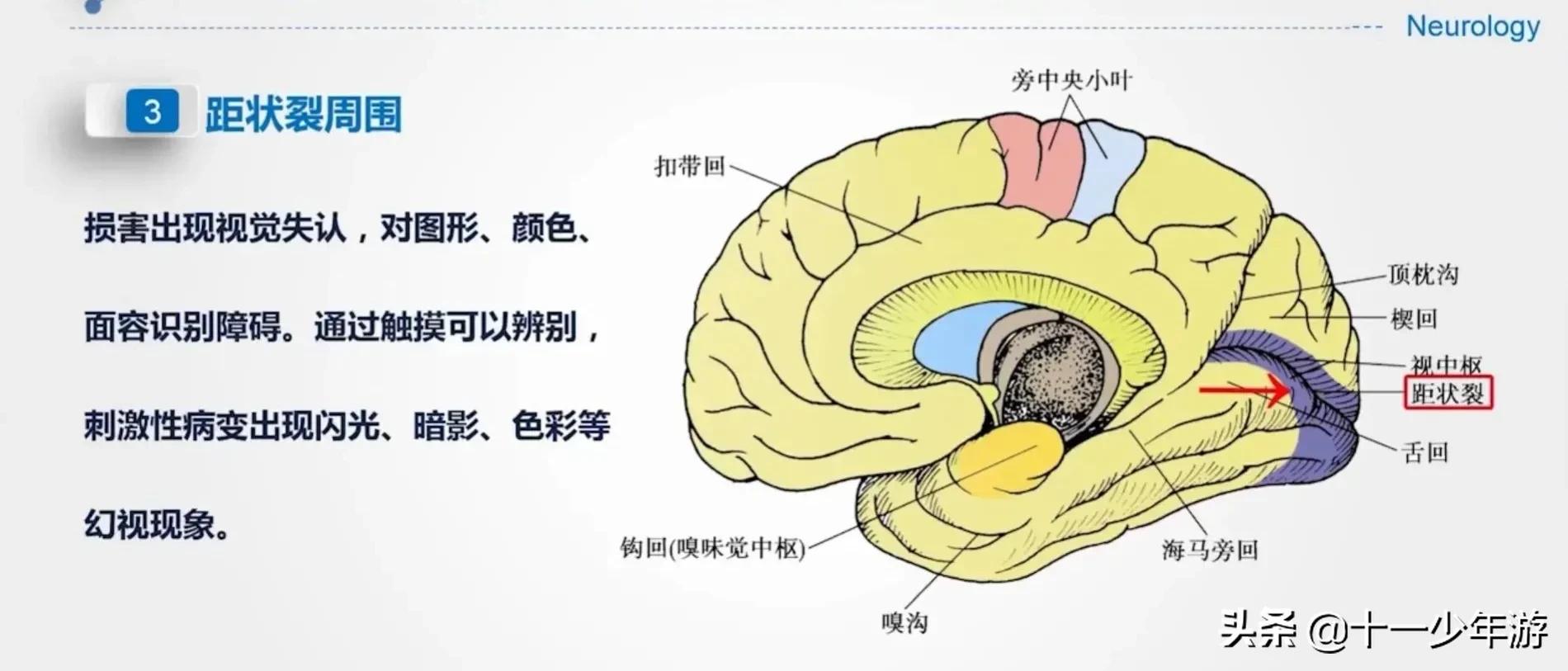 大脑的结构解剖示意图,大脑镰下疝解剖结构