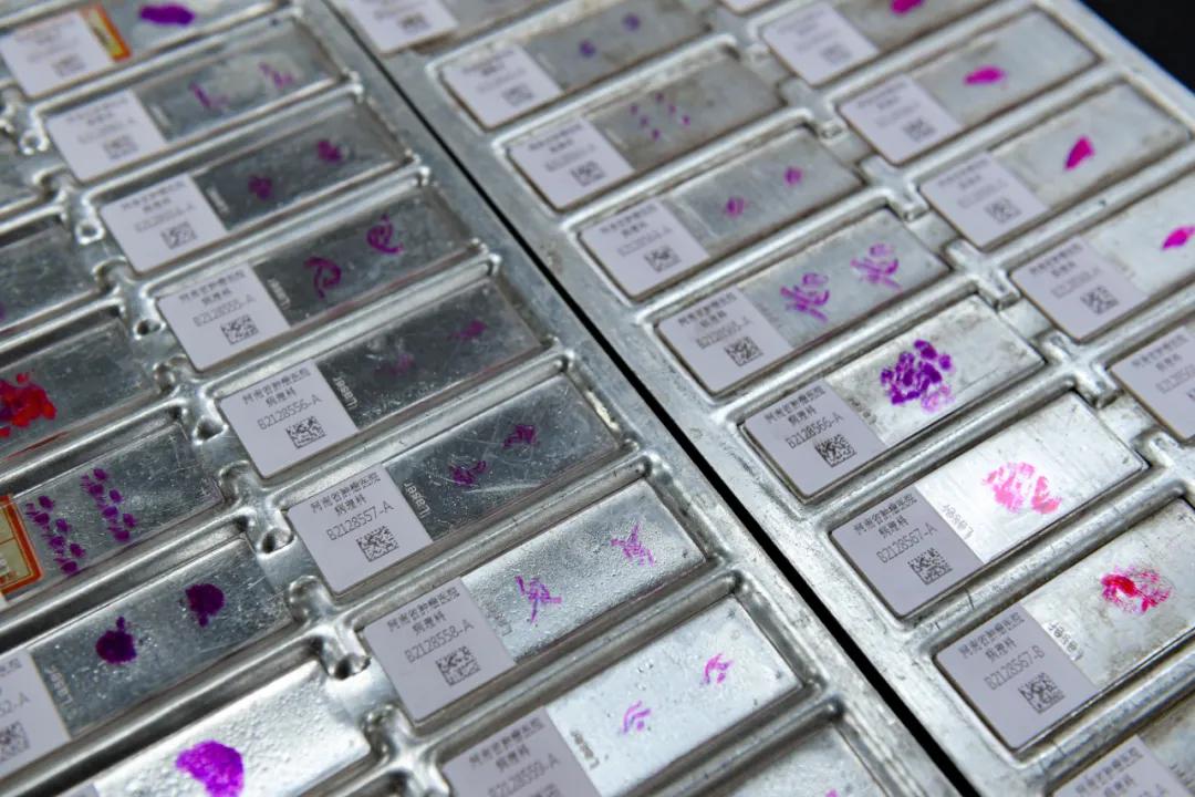 活体病理切片是什么,探访医院病理科