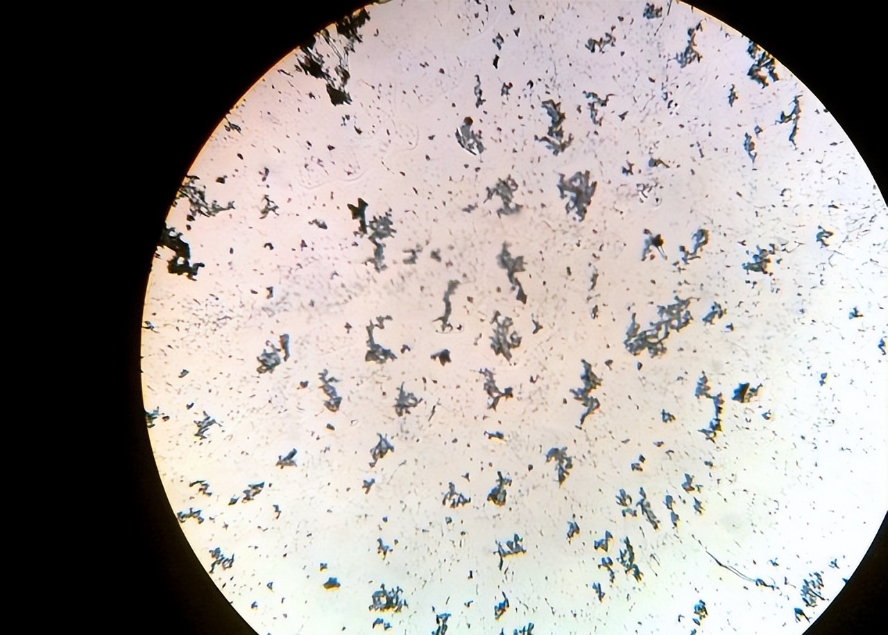 吃了发霉的水果会怎么样,吃腐烂发霉的水果的后果