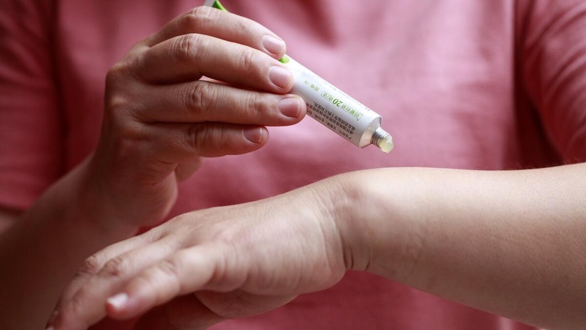 几块钱的“红霉素”软膏,竟是*褐斑黄**的“克星”?医生告诉你真相