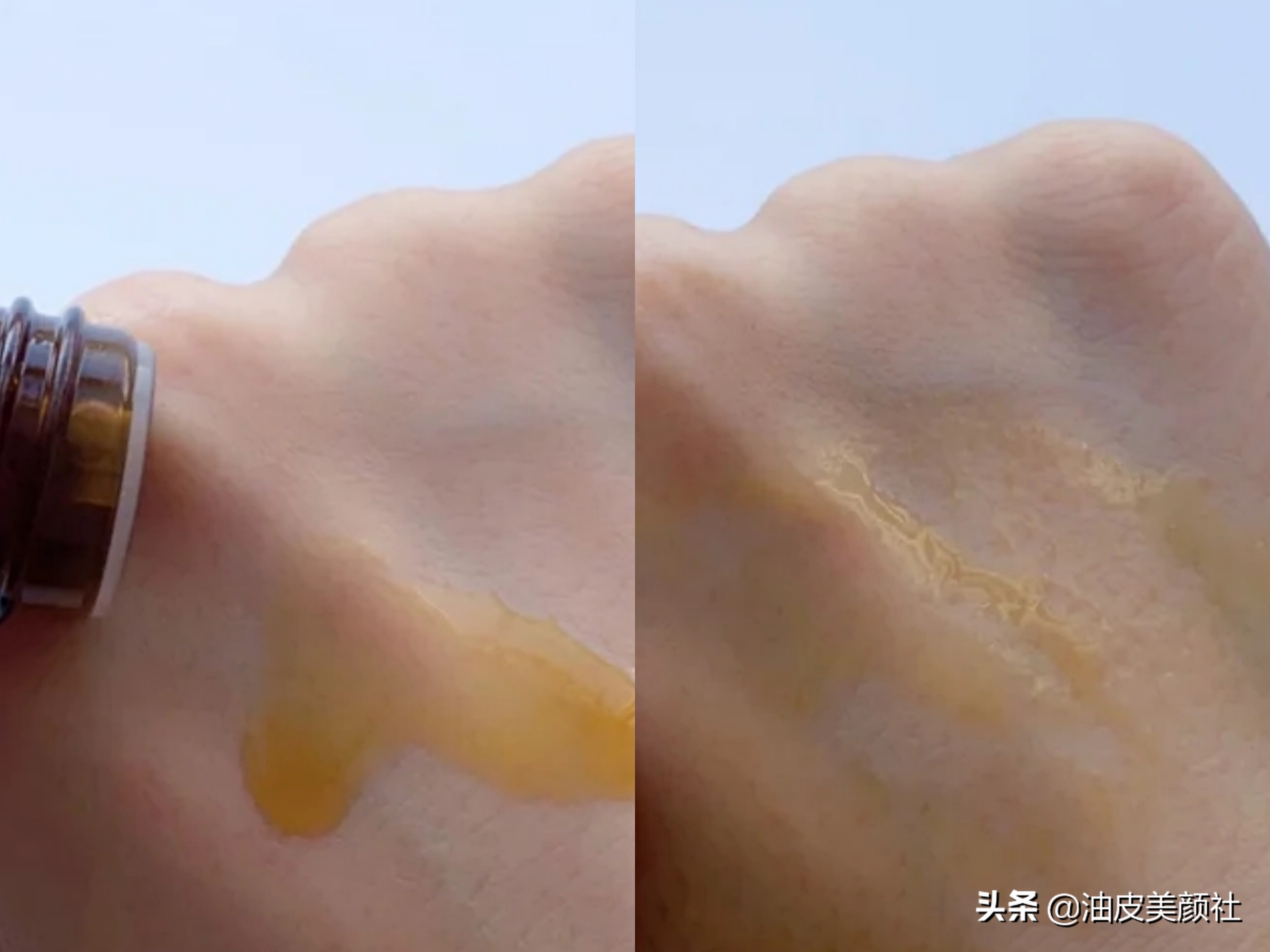 祛痘好物推荐一下,推荐十款实用的祛痘产品