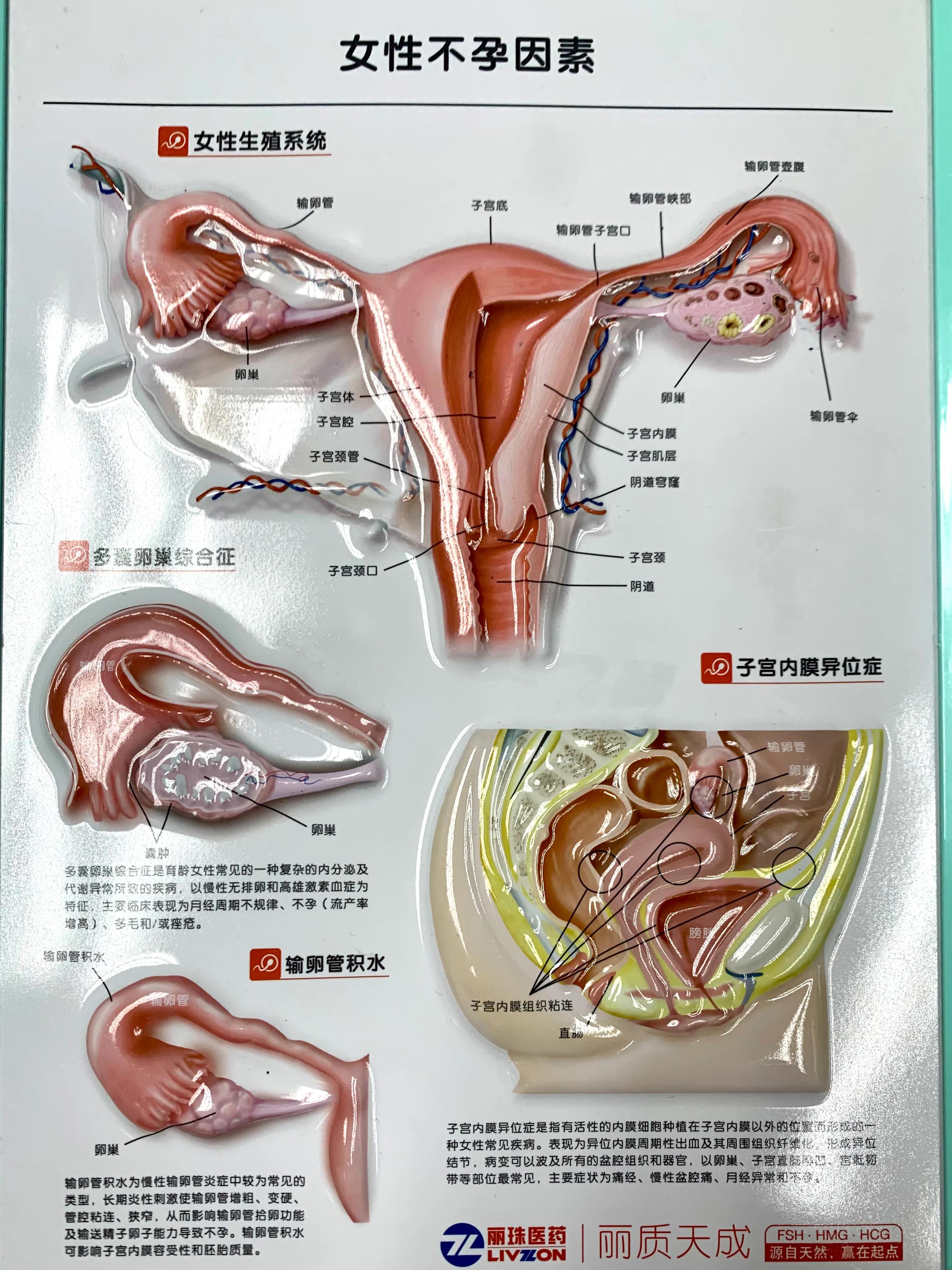 妇科医生讲述真实故事,妇产科手术室里的故事