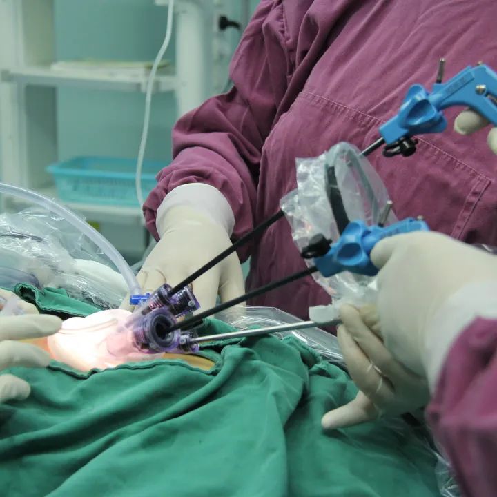 “术过无痕”,一个小孔解决孩子大问题