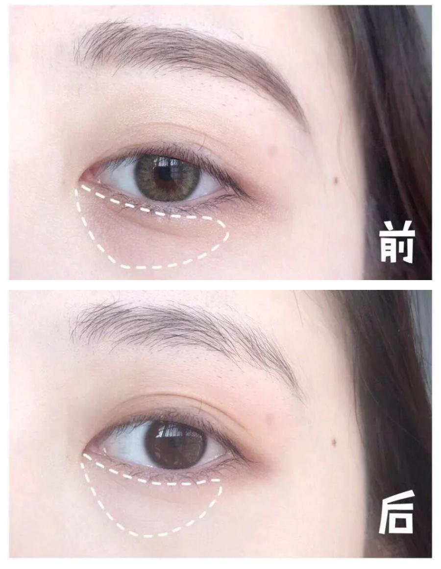 新款兰蔻小黑瓶眼霜里面有细闪吗,兰蔻菁纯淡纹黑眼圈眼霜