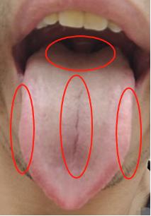 虚寒胃疼一味中成药,一吃凉的就胃疼吃什么药