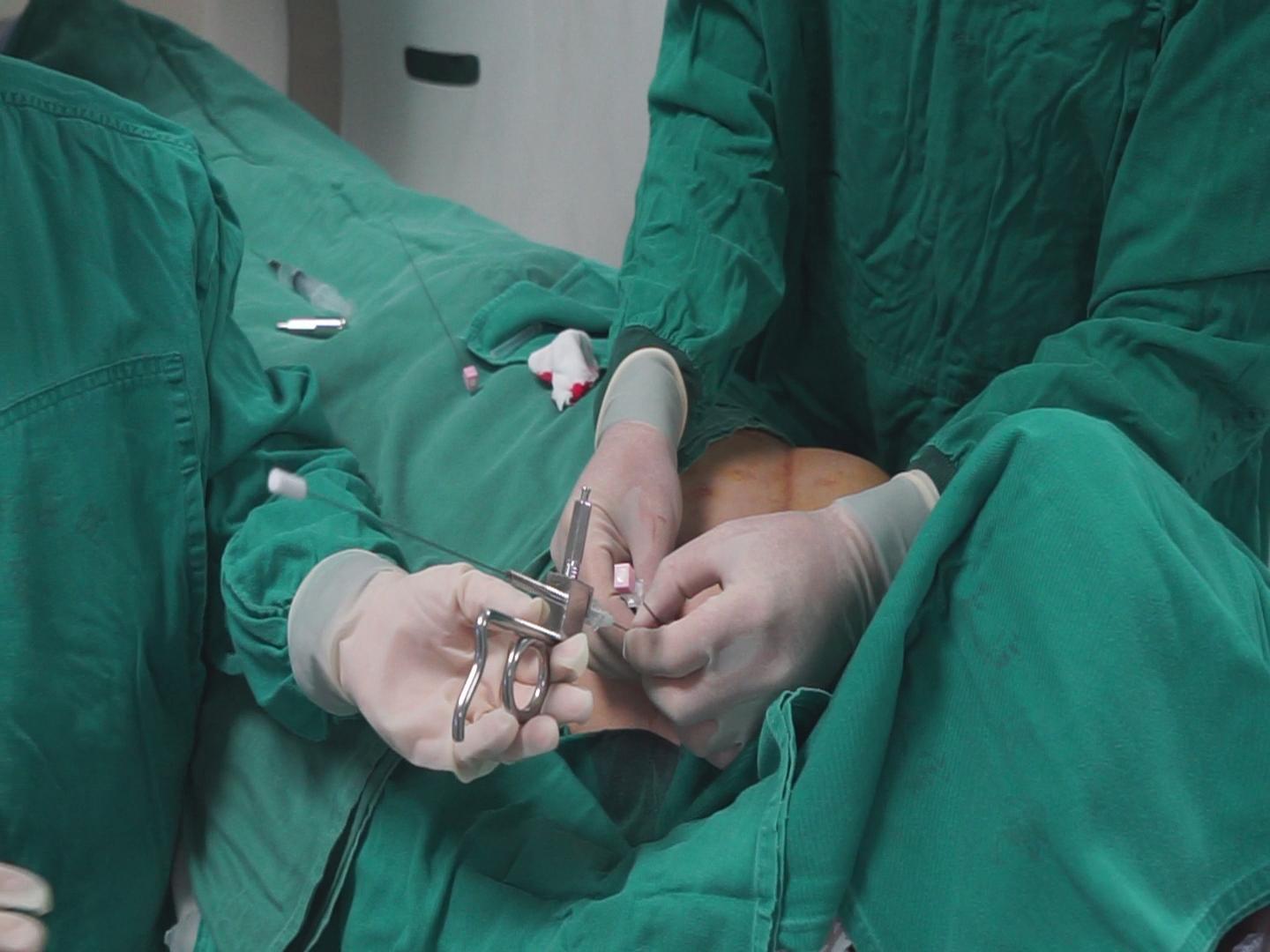 粒子植入治疗淋巴结转移,小细胞肺癌纵隔淋巴结转移后手术