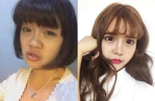 为了巴掌脸，把骨头削去一半，你害怕吗？