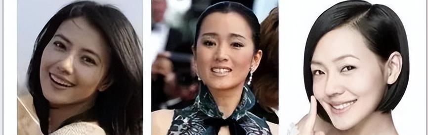 明星的牙都很齐吗,明星的牙齿都很好看