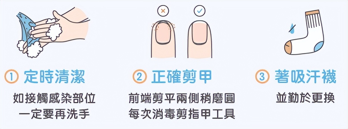 灰指甲会传染别人吗怎么治疗,灰指甲对孩子的传染率高吗