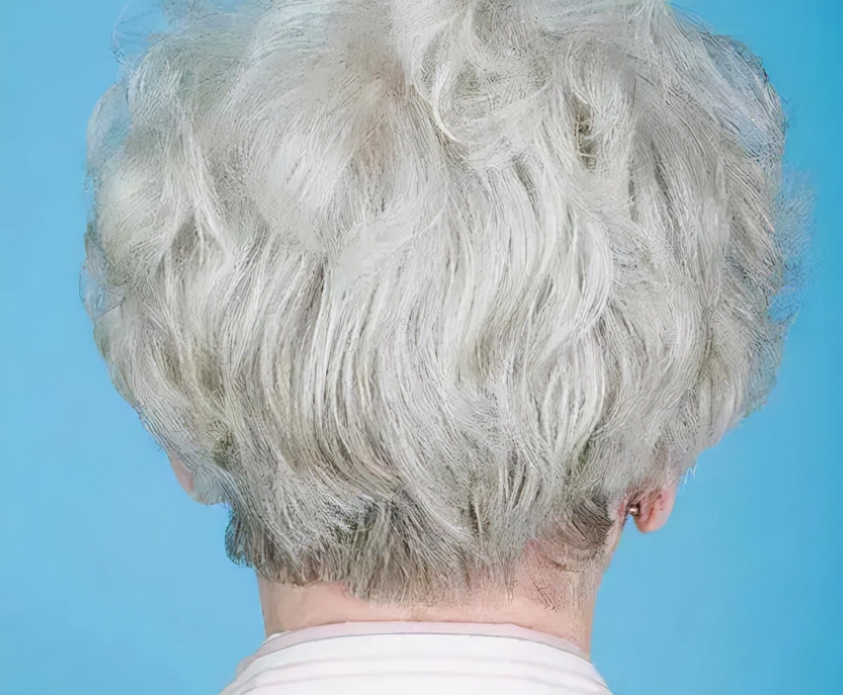 年轻人白头发缺少哪种营养,白头发越来越多是缺少什么营养吗