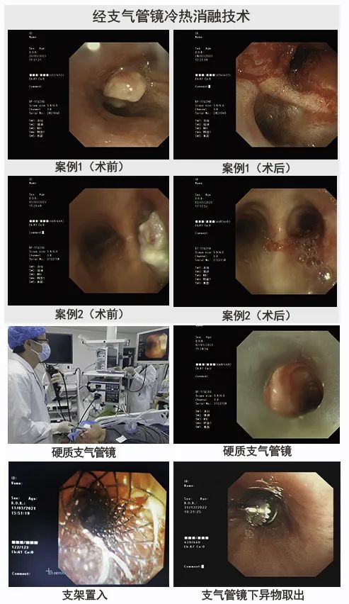 就医不迷路这份指南请收好,重庆市人民医院重症医学科