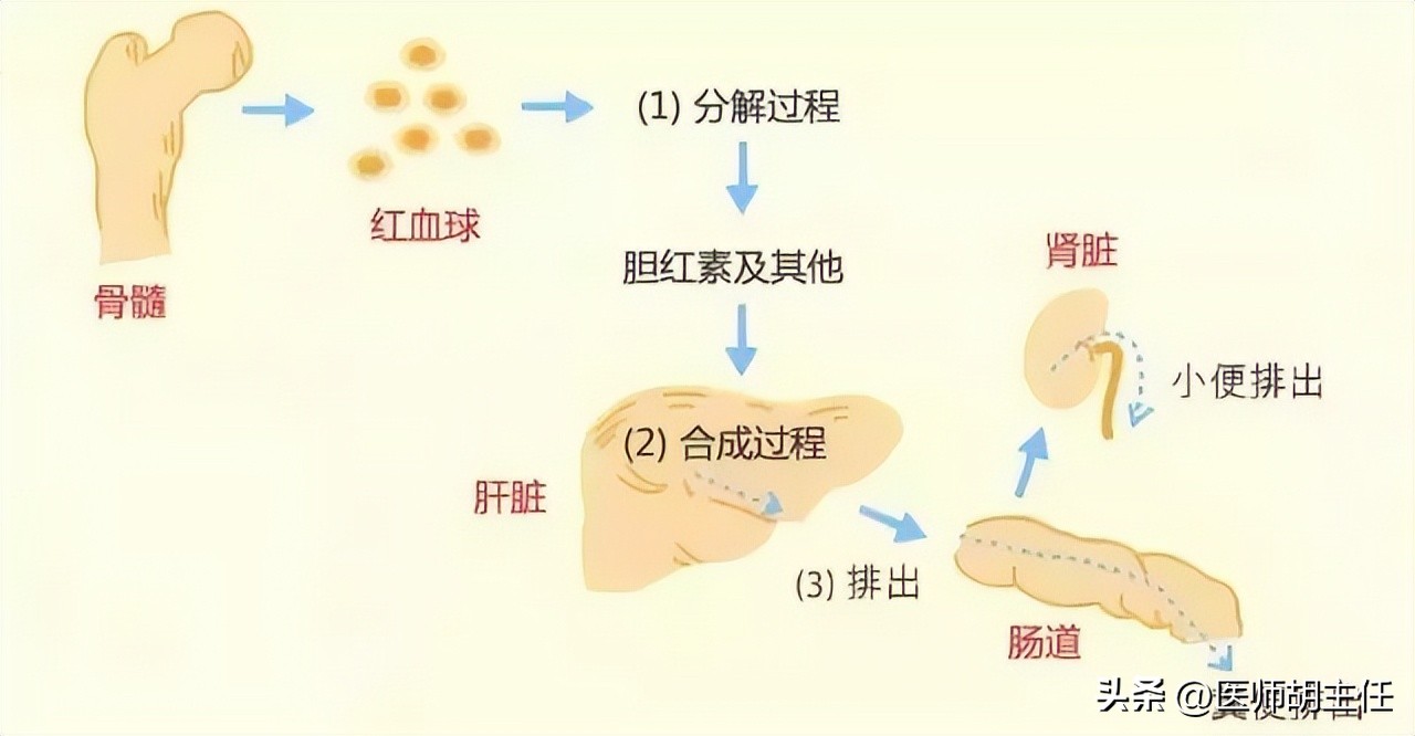 肝病胆红素偏高怎么才能降下来,体检胆红素偏高怎么快速降低